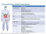 Immunotherapy Side Effects Management Pictures