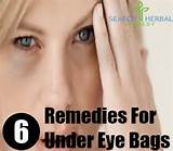 Home Remedies Eye Bags Images