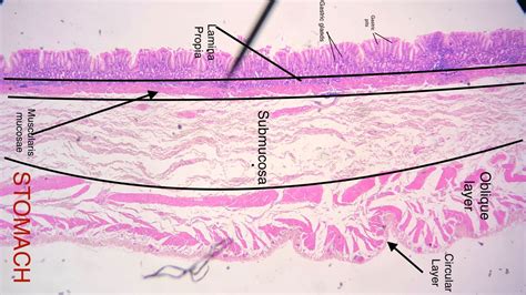Histology Of Esophagus Labeled