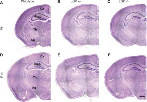 Brain Morphology Of LGI1 Mice AC At Postna Open I