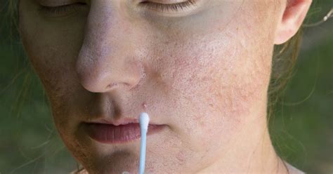 The pimples and bumps heal slowly, and when one begins to go away, others seem to crop up. How to Get Rid of Allergic Reactions on Your Face Such As ...