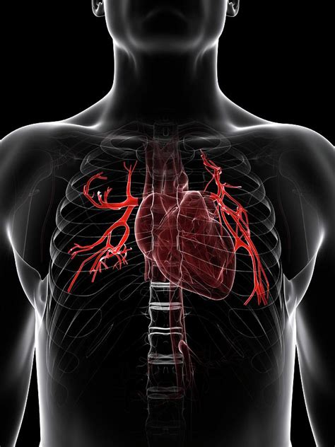 Pulmonary Arteries Photograph By Scieproscience Photo Library Fine