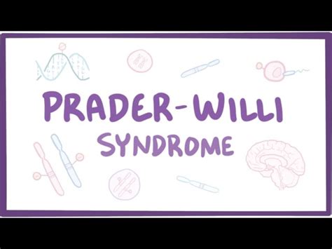 Prader Willi Syndrome Causes Symptoms Diagnosis Treatment