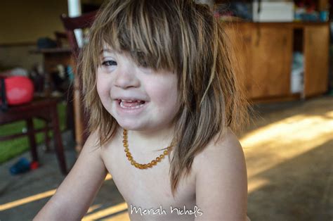 Nude Downs Syndrome Girls