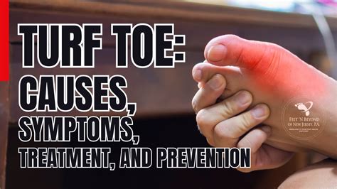 Turf Toe Unveiled Causes Symptoms Treatment And Prevention