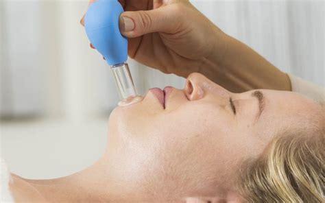 Facial Cupping Best Day Spa In London On Beauty Total Spa