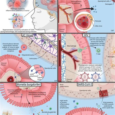 Of Pathogens And Their Interactions With The Choroid Plexus