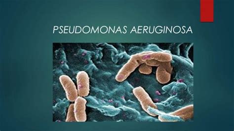 Infecciones Por Pseudomona Aeruginosa