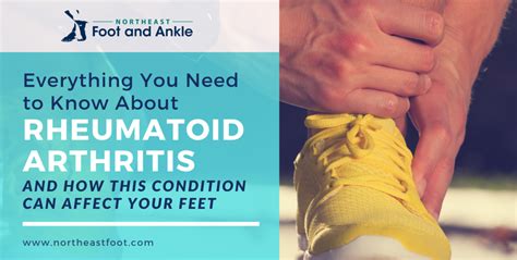 Everything To Know About Rheumatoid Arthritis Ne Foot And Ankle