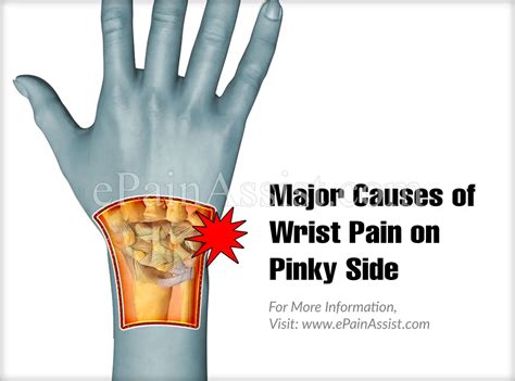 Wrist Anatomy Ulnar Side