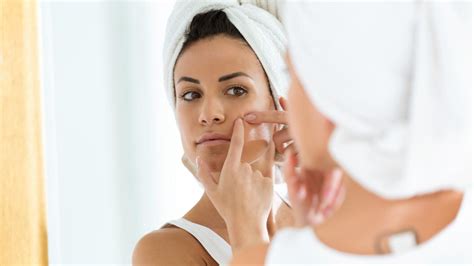 Beauty Trick Pickel Patches Gegen Hautunreinheiten Das Steckt Dahinter