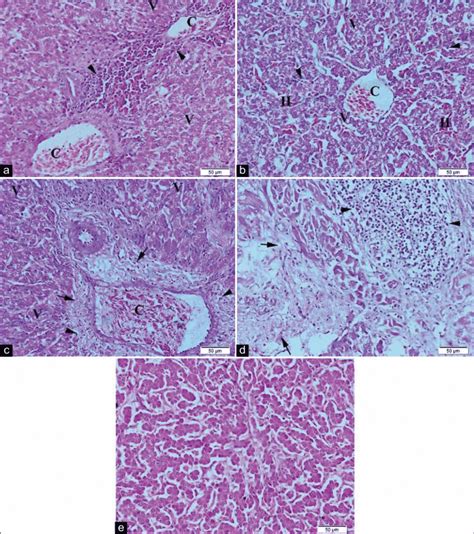 Representative Photomicrographs Of Liver Histopathology 20× A The