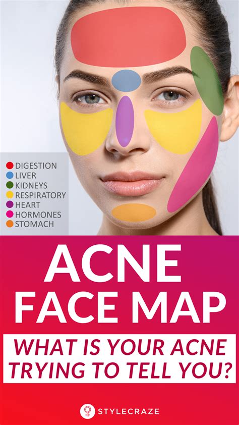 What Is An Acne Face Map Purewow