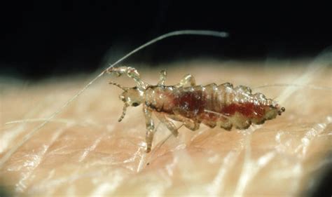 Since you now know how to get rid of nits in long thick hair, you know how to treat lice in long hair. How to get rid of lice - adults should use THIS treatment ...