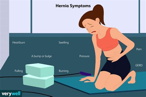 Hernias Painful Vseramouse