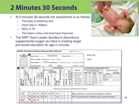 Ppt Bc Newborn Resuscitation Record Psbc 1980 Powerpoint