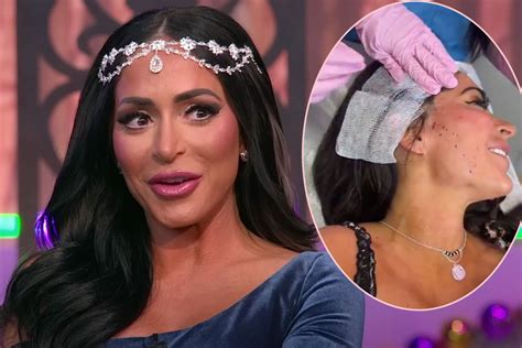 Jersey Shores Angelina Pivarnick Shocks Fans With Graphic Facelift Video Watch Perez Hilton