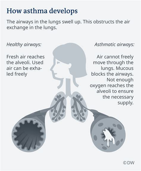 How Do I Get Asthma