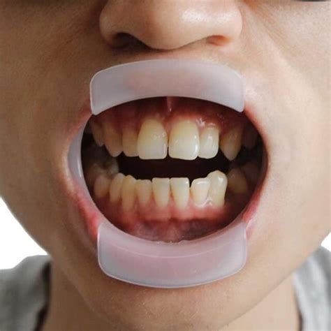 O Type Dental Teeth Whitening Cheek Retractor Lip Mouth Opener Holder