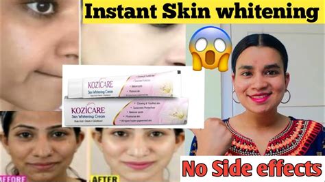 Kozicare Kojic Acid Skin Whitening Cream Complete Review Reduce Dark