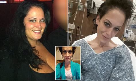 Obese Mother Of Four Claims A Gastric Sleeve Operation Caused Her To