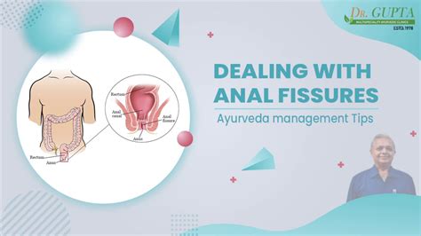 Dealing With Anal Fissures Ayurveda Management Tips By Dr Bhupinder K Gupta Youtube