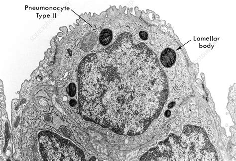 Alveolar Cell Stock Image P5900272 Science Photo Library