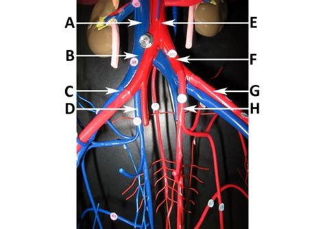 Blood vessels 2 labeled palmar arch digital artery right femoral a right femoral v great saphenous vein left popliteal a right anterior tibial a. nUOyAGFlaqRaD-zDjdFSKw.jpg