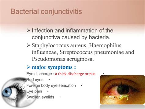 Ppt Eye Infection Powerpoint Presentation Free Download Id2049121