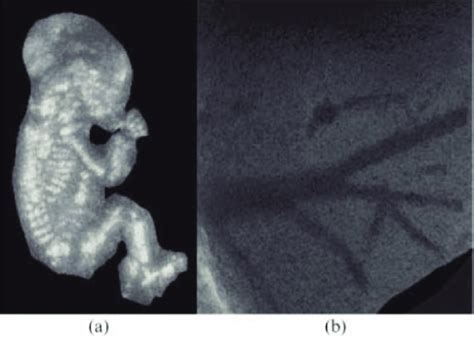 The Different Volumes Rendering Visualization Of 3d Ultrasound Imaging