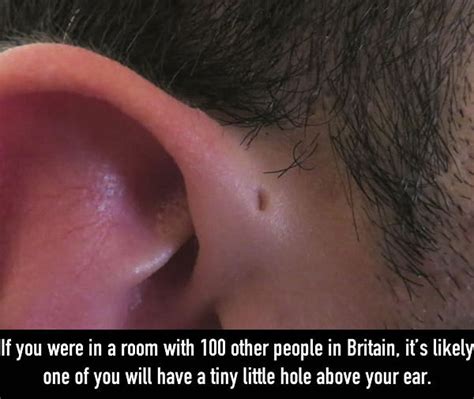 The Reason Why Some People Have Little Holes Above Their Ears 5 Pics