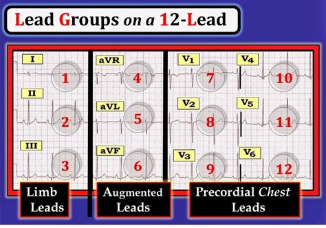 Ecg Interpretation Ecg Blog 91 Basic Concepts 4 Lead Groupings