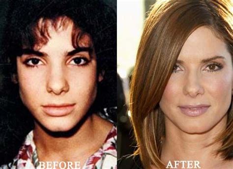 8 Plastic Surgery Sandra Bullock Plastic Surgery Before And After Nose