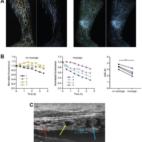 Emerging Clinical Imaging Techniques A Optoacoustic Imaging Medial