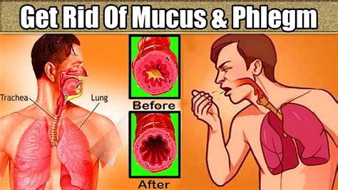 Just 1 Day Get Rid Of Mucus In Lungs Mucus In Throat Cure Get Rid Of