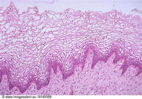 Labia Minora Lm Labia Minora Lm Female Female Reproductive System
