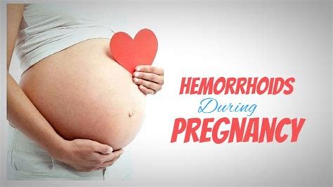 Best Home Remedies For Hemorrhoids During Pregnancy