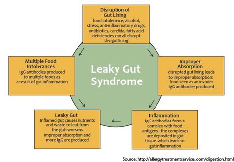 Leaky Gut Syndrome Treatment And Cure Health And Medical And Nutrition