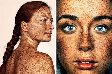 These Portraits Celebrate The Joy Of Having Freckles Photography Projects Art Photography