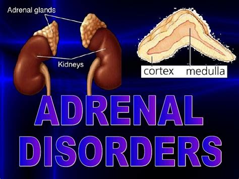 Adrenal Disordersppt