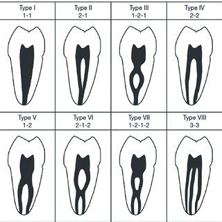 Relationship Of Canal Configuration Vertucci S Classification Of