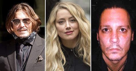 Johnny Depp Reveals Photos Of Alleged Injuries From Amber Heard Fights