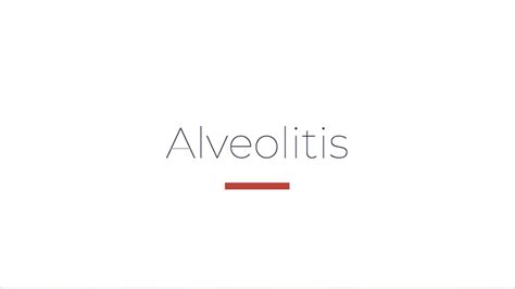 Qué Es La Alveolitis Y Como Se Trata Dr Javier De La Cruz Youtube