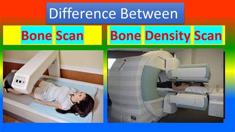 Difference Between Bone Scan And Bone Density Scan Youtube