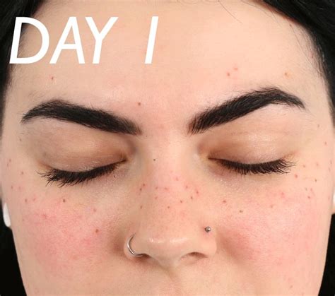 Heres Everything That Happens When You Get Freckle Tattoos Faux