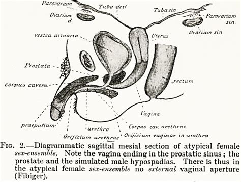 Male Vs Female Hip Structure Cumception