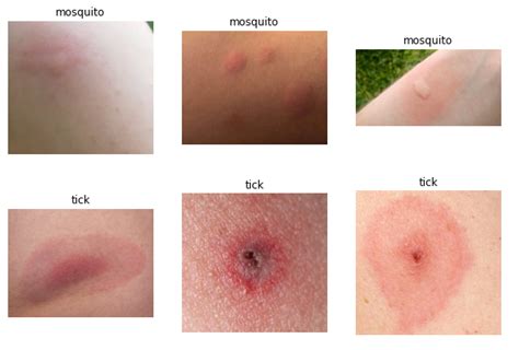 Effect Of Insect Bites And Stings Of Our Body