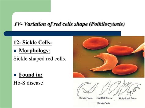 Ppt Rbcs Abnormal Morphology Powerpoint Presentation Free Download