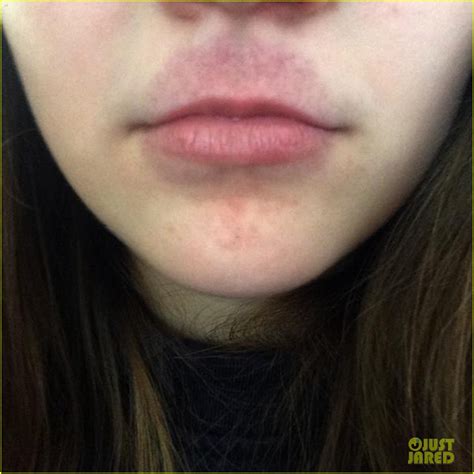 Kylie Jenner Challenge Is Making Headlines See These Crazy Lip Pics Photo Kylie