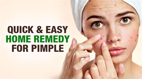 How To Remove Pimples Fast At Home Home Remedy For Pimple Beauty